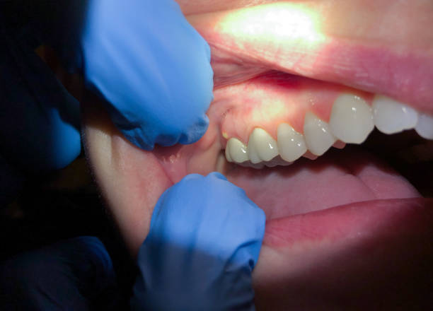 Best Same-Day Emergency Dentist in Cornersville, TN